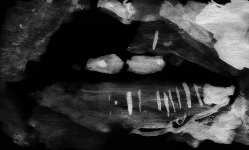 Black And White Lips GIF by TraceLoops