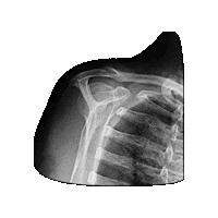 Bones Xray Sticker