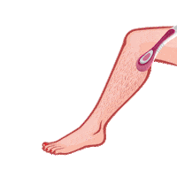 Razor Hair Removal Sticker by LetsShave