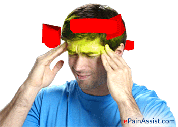 headache information center GIF by ePainAssist
