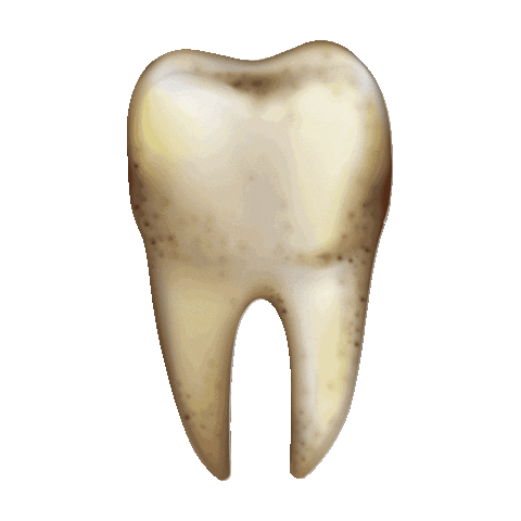 Cabrera_Odonto giphyupload implante aparelho cabrera Sticker