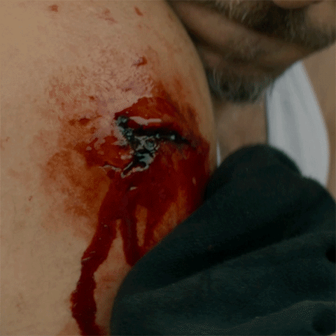 cbs all access blood GIF by CBS