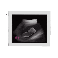 Ultrasound Radiology Sticker