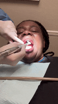 Dental Work Cleaning GIF