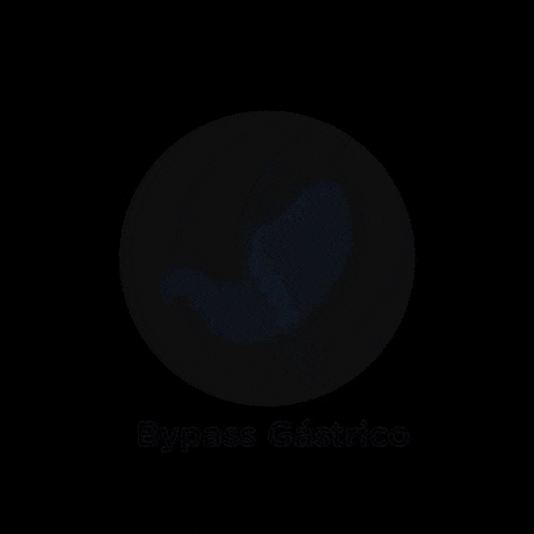 Stomach Bypass GIF by Dr. Bortolotti