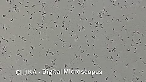 medprime giphygifmaker microscope microscopy digital microscope GIF