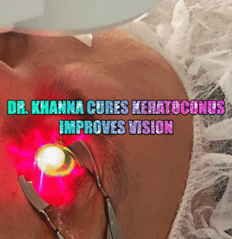 rkmd giphygifmaker vision cornea cxl GIF