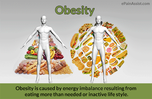 causes of obesity GIF by ePainAssist