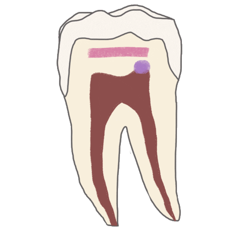 Pulp Endodoncia Sticker