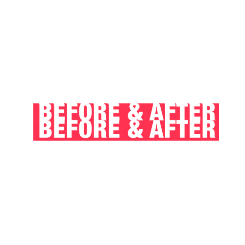 Before And After Skincare Sticker by FaceGym