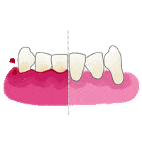 Perio Periodoncia Sticker
