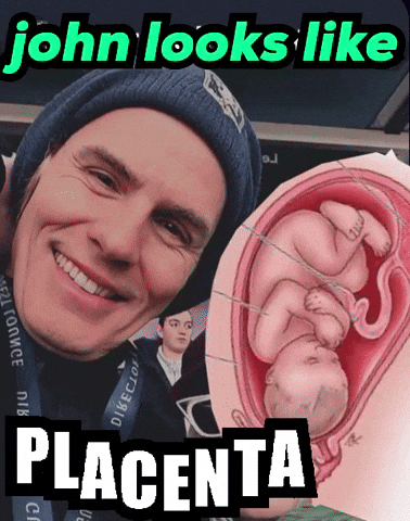 Duran Duran Placenta GIF
