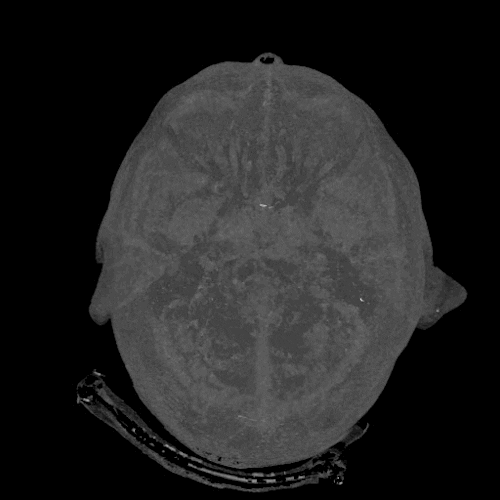brain scans tech GIF by General Electric