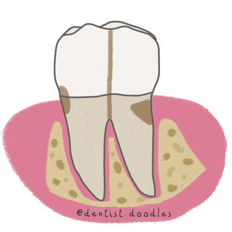 Decay Caries Sticker