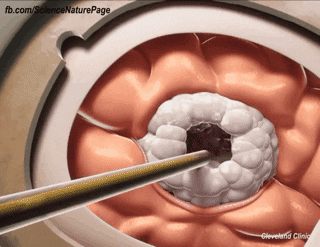 skagk giphyupload GIF