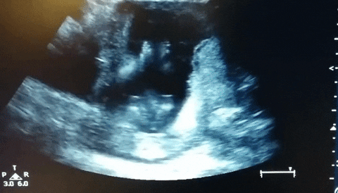 video baby GIF