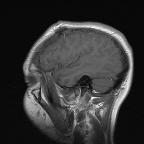 brain GIF
