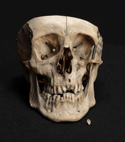 skull brushorelse GIF by Mütter Museum