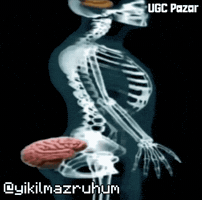Brain Low Iq GIF by UGCPazar