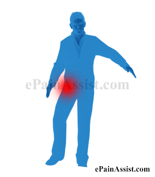 unusual movements hip tendonitis GIF by ePainAssist