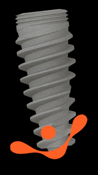 singularimplants odontologia sorriso dentário singularimplants GIF