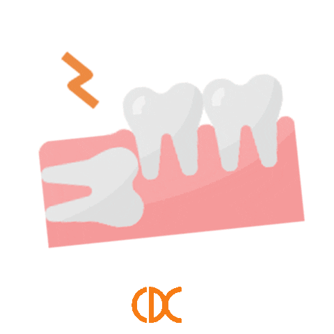 Charlestown-Dental-Centre giphyupload smile smiling teeth Sticker