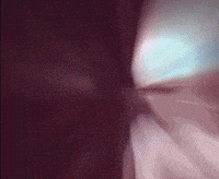 Blitz The League Concussion GIF