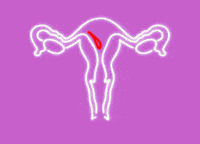 Menstruation Bleeding GIF by Period Nirvana