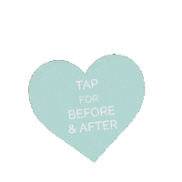 NAGENordicBeauty botox restylane ultherapy nage Sticker