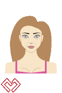 Plastic Surgeon Fillers Sticker by Mantalos Plastic Surgery