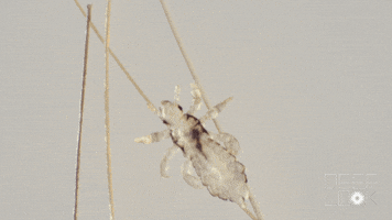 hair lice GIF by PBS Digital Studios
