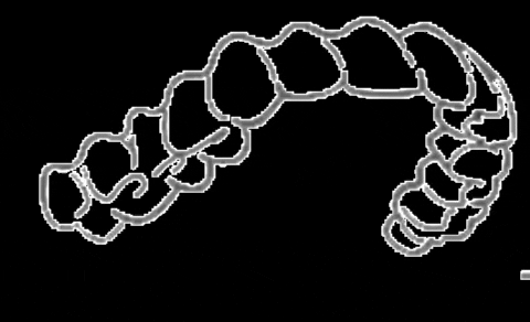 alinhadoresmoov giphygifmaker ortodontia dentes moov GIF