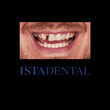 Implant Smile GIF by ISTADENTAL CLINIC