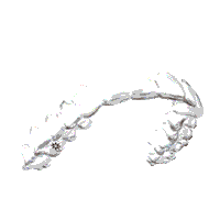 Aligner Nvo Sticker by nvorthodontics