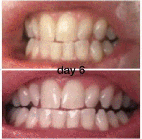 ivorysmilez giphyupload GIF