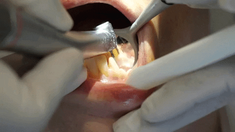 sonriemanta giphyupload teeth dentist odontologia GIF