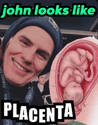 Duran Duran Placenta GIF