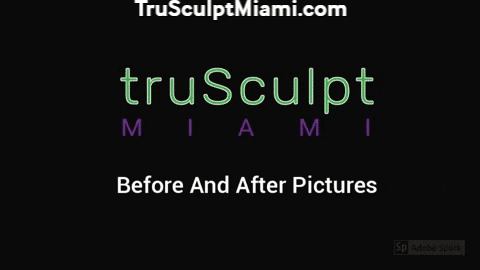 trusculpt giphygifmaker aesthetics body sculpting trusculpt GIF