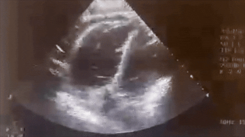 giphyupload GIF