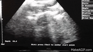 in utero GIF