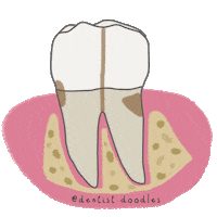 Decay Caries Sticker