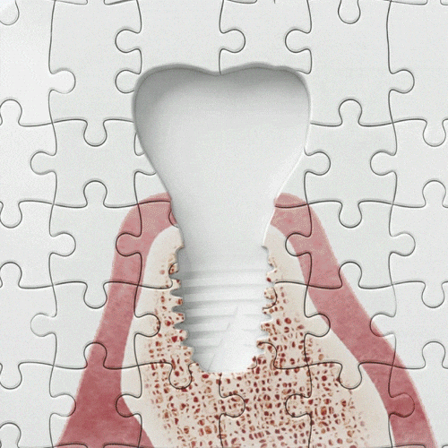 Teeth Tooth GIF by MegaGen Implant