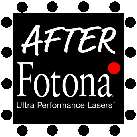 Before And After GIF by Fotona Lasers