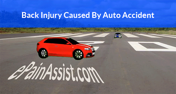 back injury caused by auto accident
