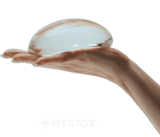 Mentorbreastimplants Sticker by Mentor Worldwide LLC