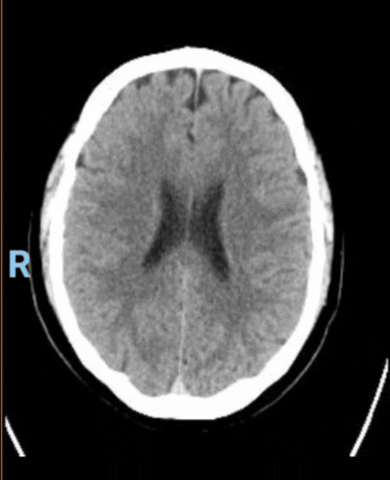 Brain Scanner GIF by Database數據
