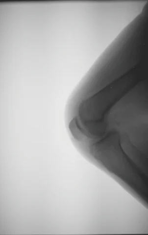 person xray GIF